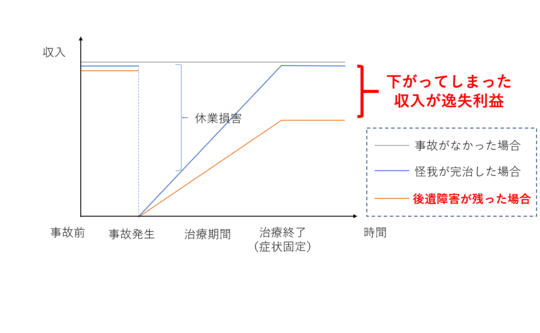 交通事故の逸失利益の計算方法 - 東京都で後遺障害・交通事故なら医療