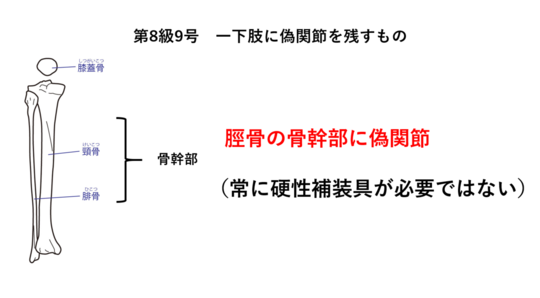 交通事故による脛骨骨折と後遺障害 ハビリス法律事務所 東京都千代田区