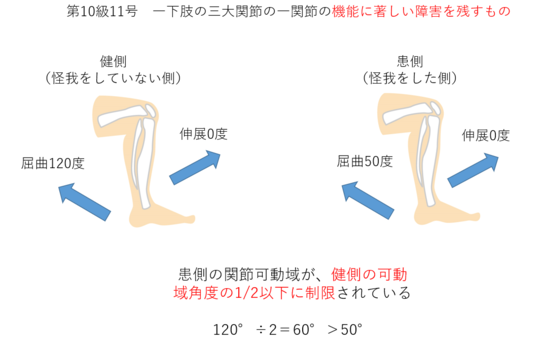 膝蓋骨骨折と後遺障害 東京都で後遺障害 交通事故なら医療資格保有弁護士のハビリス法律事務所へ